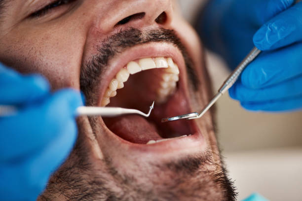 Best Emergency Treatment for Toothache in Dennison, OH