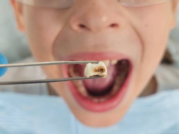 Best Emergency Dental Care for Trauma or Injury in Dennison, OH